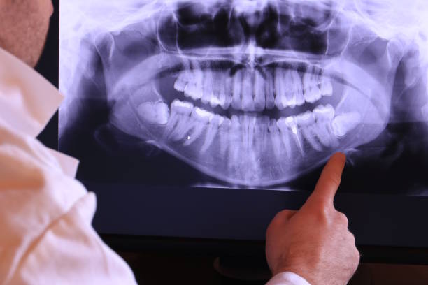 Best Emergency Wisdom Teeth Removal in Jonestown, TX