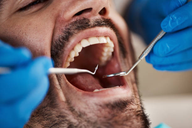 Best Emergency Wisdom Teeth Removal in Jonestown, TX
