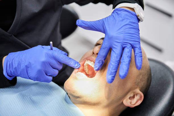 Best Emergency Tooth Extraction in Jonestown, TX